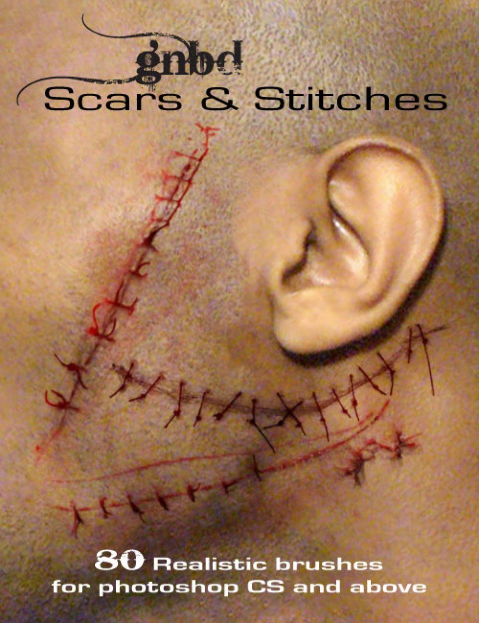 GNBD Scars & Stitches_DAZ3D下载站