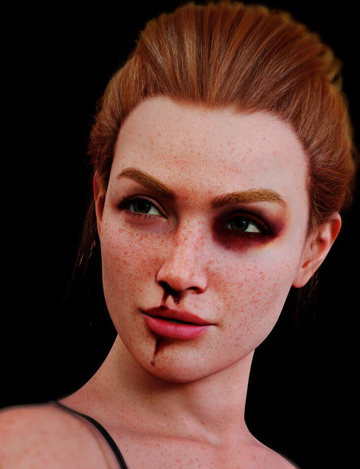 LA Facial Bruises for Genesis 9_DAZ3D下载站